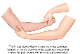 Image result for Elbow Extension Test