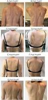 Image result for Winged Scapula