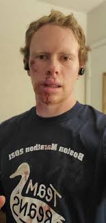 There was one time, I crashed my bike: and the next thing I remember I wake  up in a stranger's bathroom with them cleaning blood off my face. (and left  half a