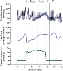 valsalva maneuver an overview sciencedirect topics