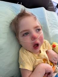 He's not feeling good today. They but him