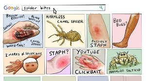 Camel spider bite pictures, how to identify? Thomas Shahan On Twitter I Ve Been Going Back And Forth On That One May Mention It As Spider Bites While Asleep In Bed Seem To Be A Common Story