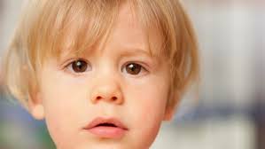 Das latente schielen ist das unauffälligste schielen bei kindern. Oft Mit Sehfehler Gekoppelt Schiel Erkrankungen Schon Bei Babys Behandeln Lassen