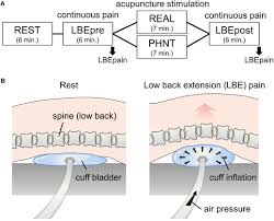 Frontiers Differential Influence Of Acupuncture