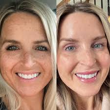 Brandy Bloom, Fnp-Bc ᴀᴇꜱᴛʜᴇᴛɪᴄꜱ ɪɴᴊᴇᴄᴛᴏʀ