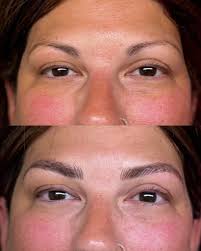 Microblading for brows in Bennington?