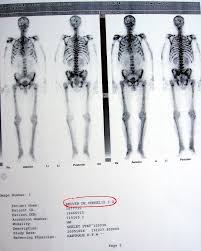 Maybe you would like to learn more about one of these? EficienÈ›a Terapiei Varumin