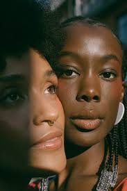 The most frustrating and embarrassing issue for most of us. How To Treat Dandruff Psoriasis Alopecia In Afro Hair