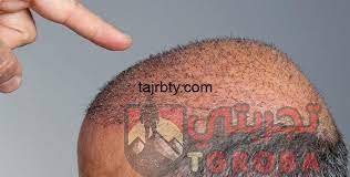 والدي زرع بي الطيبة والجدعنة وحب الغير، وكان كريما جدا لدرجة أن والدته. Ø§Ø­Ù…Ø¯ Ø§Ù„Ø³Ù‚Ø§ Ø²Ø±Ø¹ Ø´Ø¹Ø± ØªØ¬Ø±Ø¨ØªÙŠ