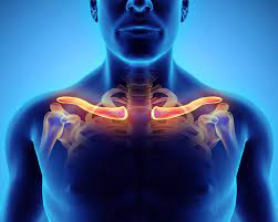 Thoracic Outlet Syndrome Presenting As An Acute Stroke Mimic