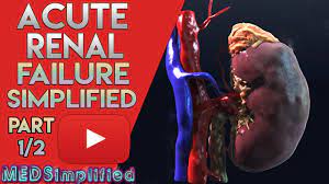 Doctors sometimes call it acute renal failure. Acute Kidney Failure Made Easy Part 1 2 Youtube