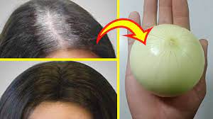 So as the hair grows in length, the melanocytes around the hair follicle inject melanin into the cortex of the hair shaft. Change White Hair To Black Hair Naturally 55 Years Old Permanently 100 Works At Home Youtube