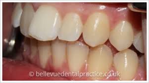 We did not find results for: Smile Gallery Of Teeth Straightening Belle Vue Dental Practice