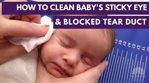  how should i clean my baby's eyes? How To Clean A Baby S Sticky Eye And Blocked Tear Duct Youtube