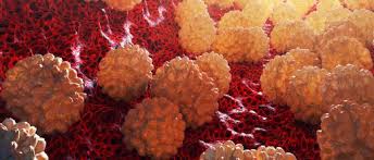 Chlamydien sind eine ansteckende geschlechtskrankheit, die durch das bakterium „chlamydia trachomatis verursacht wird. Chlamydien Symptome Test Ansteckung