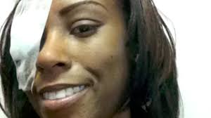 Woman Sues Hospital After Frightening Discovery of Camera Left Inside Her  During Surgery