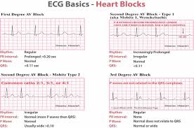 Check spelling or type a new query. Heart Block Causes Symptoms Types Diagnosis And Heart Block Treatment