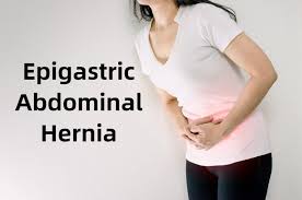 Image result for stomach hernia symptoms