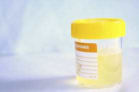 Beberapa hormon, enzim, dan garam mineral juga akan ditemukan dalam urin. Tahukah Anda 9 Warna Air Kencing Ini Menerangkan Tahap Kesihatan Tubuh Badan Kita