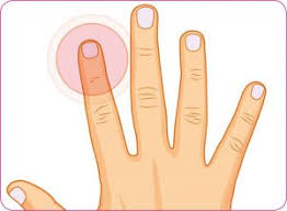 Zugsalbe Gegen Nagelbettentzundung Zugsalbe Effect