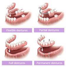 Affordable Flexible Partial Dentures Brooklyn Denture Repair
