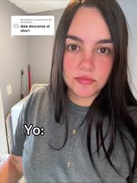 Respuesta a @Antovelez_ 🐸🐸 #paratii #viralvideo #🐸🐸