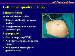 This method has been used in 15 patients and allowed the adhesions to be cleared where necessary. Safe Entry In Laparoscopy Ppt Video Online Download