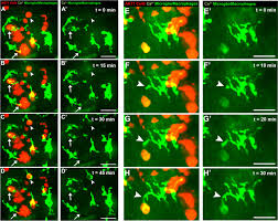 Be aware of your risk. Brain Tumours Repurpose Endogenous Neuron To Microglia Signalling Mechanisms To Promote Their Own Proliferation Elife