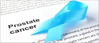 Prostate cancer is one of the most common types of cancer diagnosed in men. Prostate Cancer Screening And Detection Decline