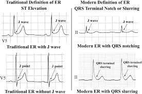 Image result for J Wave
