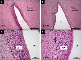 Así, una hipoxia cerebral se produce cuando al cerebro no le llega suficiente oxígeno. Hipoxia Isquemia Neonatal Bases Celulares Y Moleculares Del Dano Cerebral Y Modulacion Terapeutica De La Neurogenesis Neurologia Com