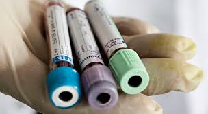 Image result for Blood Doping