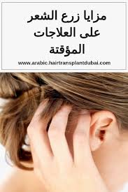 مزايا زرع الشعر على العلاجات المؤقتة زراعة شعر في دبي Hair Transplant Hair Engagement