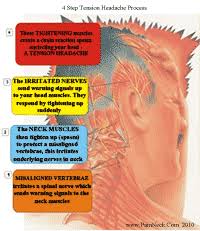 Posture, neck injuries and other minor. Head And Neck Pain Pain Neck