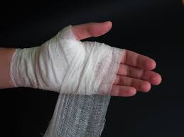 Image result for Hand Fracture