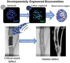 Free 3d bone models for download, files in 3ds, max, c4d, maya, blend, obj, fbx with low poly, animated, rigged, game, and vr options. Developmentally Engineered Callus Organoid Bioassemblies Exhibit Predictive In Vivo Long Bone Healing Nilsson Hall 2020 Advanced Science Wiley Online Library
