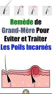 Remede De Grand Mere Pour Eviter Et Traiter Les Poils Incarnes Memes Movie Posters