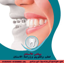 العناية بالاسنان والمحافظة على نظافة الاسنان أثناء تقويم الاسنان يساعد على الوقاية من كثير من الامراض مثل التهاب اللثة والذى قد ينت movie posters movies poster