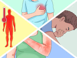 كيفية علاج حرق شمسي حاد 13 خطوة صور توضيحية wikihow