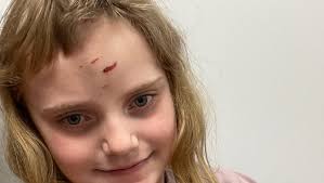 Fundraiser by Jodie Holewell : Delilah's medication and helmet