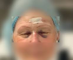 Clinician Safety in NORA