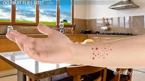 Image result for Fly Bite