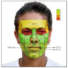 Smartphone-Based Facial Scanning as a Viable Tool for Facially Driven  Orthodontics?