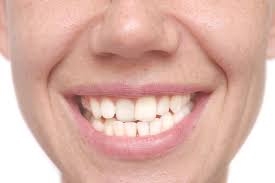There has never been a better time to fix crooked teeth and improve your smile than today. Can Cosmetic Dentistry Fix Crooked Teeth High Street