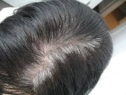 Do You Find Gray Roots And Regrowth Peeking Through Your Hair Toppik Is A Great Way To Hair Highlights And Lowlights Hair Highlights Highlights And Lowlights