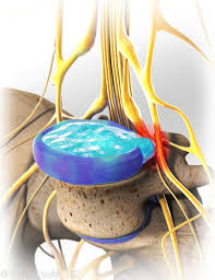 Pin On Patient Education
