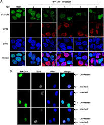 Hsl (hue, saturation, lightness) and hsv (hue, saturation, value, also known as hsb or hue, saturation, brightness) are alternative representations of the rgb color model. Human Antiviral Protein Ifix Suppresses Viral Gene Expression During Herpes Simplex Virus 1 Hsv 1 Infection And Is Counteracted By Virus Induced Proteasomal Degradation Molecular Cellular Proteomics