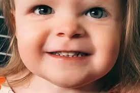 Sudden Unexplained Death in Childhood explained