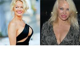 Home senza categoria pamela anderson prima e dopo, notate qualche differenza…. Chirurgia Estetica Da Pamela Anderson A Nicole Kidman Le Star Pentite Di Aver Rifatto Il Seno Corriere It