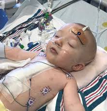 Fundraiser by Abby Skrivseth : Rally for Freddy the Fighter